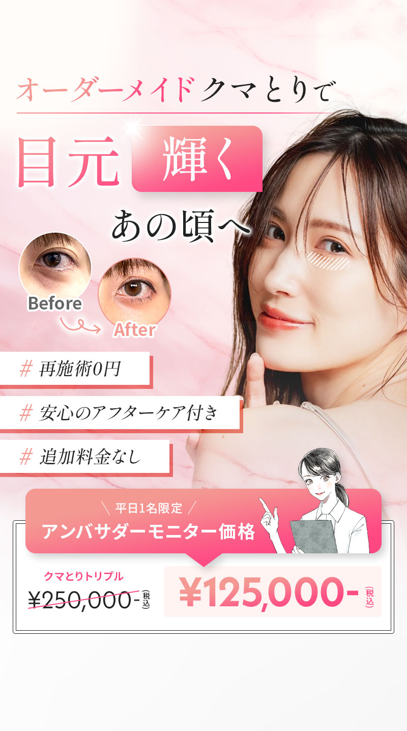 切らないクマとり 目元輝くあの頃へ 再施術0円 追加料金なし 安心のアフターケア付き 平日1名限定 アンバサダーモニター価格で税込125,000円・クマ取り・クマとり・目元 クマ取り・クマとり 大阪・目の下 クマ取り・クマ 取り 名医・クマ 取り 裏 ハムラ・クマ 取り 大阪・クマ 整形 大阪・裏 ハムラ 法 名医 関西・ミルクリニック・ミルクリニック 大阪・ミルクリニック 心斎橋・ミルクリニック 裏ハムラ・ミルクリニック クマ取り