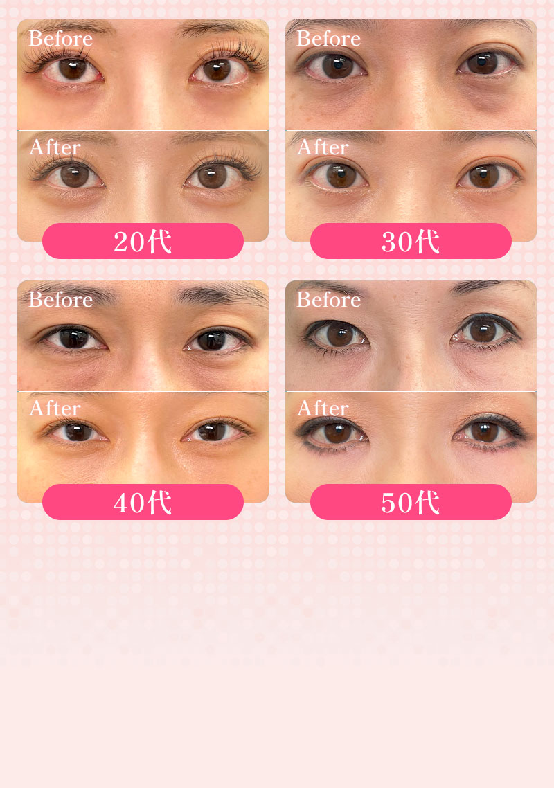 20代～50代の手術前後比較の画像