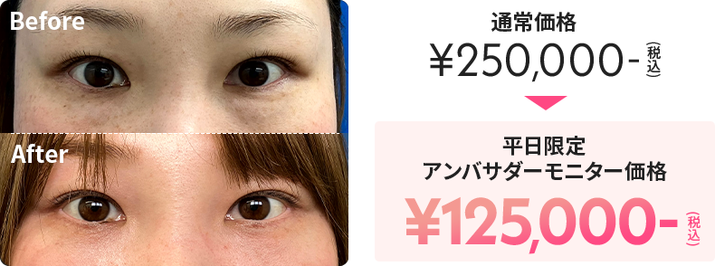 通常価格が税込250,000円のところ、平日限定のアンバサダーモニター価格で税込125,000円
