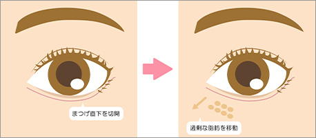 表ハムラの施術解説