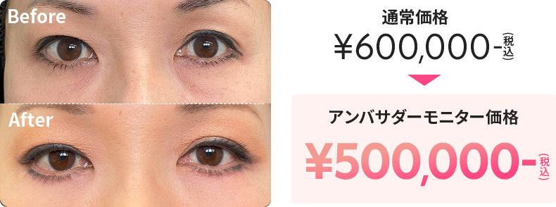 通常価格が税込600,000円のところ、アンバサダーモニター価格で税込500,000円