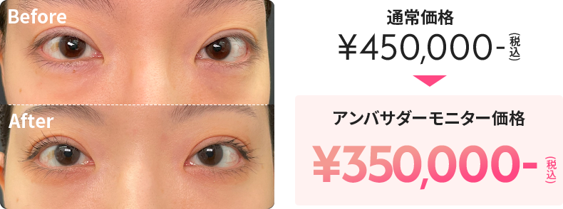 通常価格が税込450,000円のところ、アンバサダーモニター価格で税込350,000円